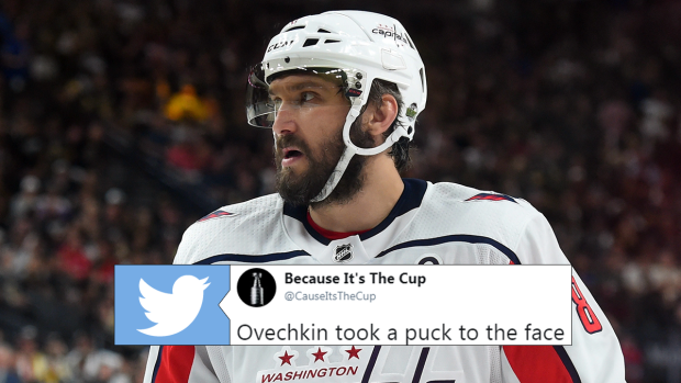 alex ovechkin pulls out his tooth｜TikTok Search